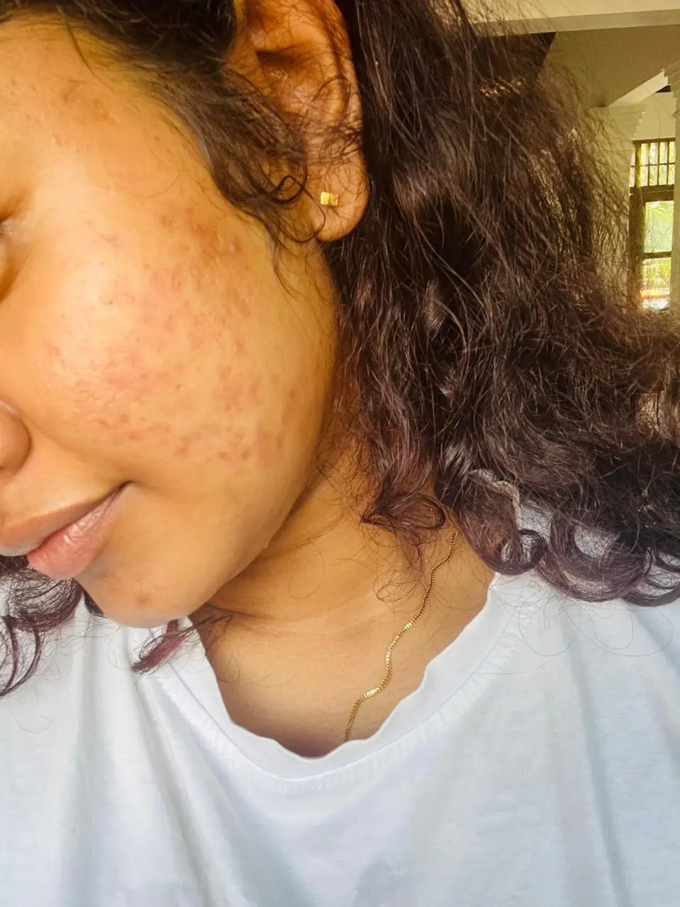 After treatment